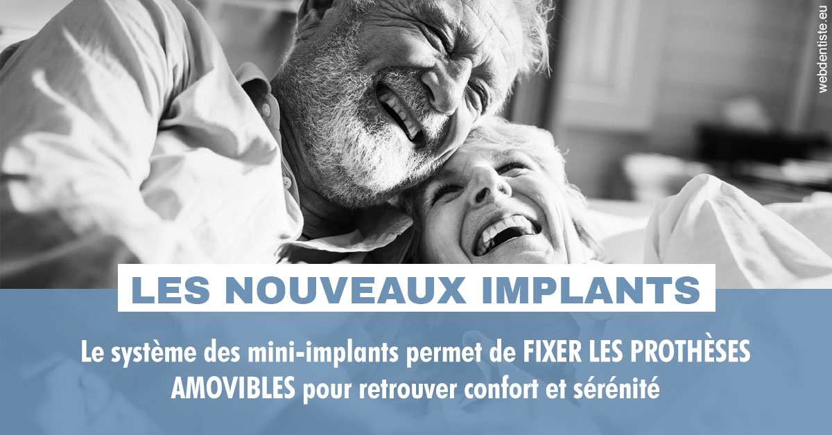 https://dr-tran-minh-hoa-cuc.chirurgiens-dentistes.fr/Les nouveaux implants 2