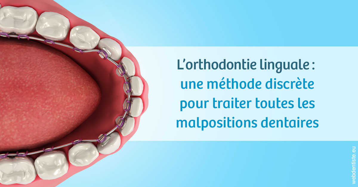 https://dr-tran-minh-hoa-cuc.chirurgiens-dentistes.fr/L'orthodontie linguale 1
