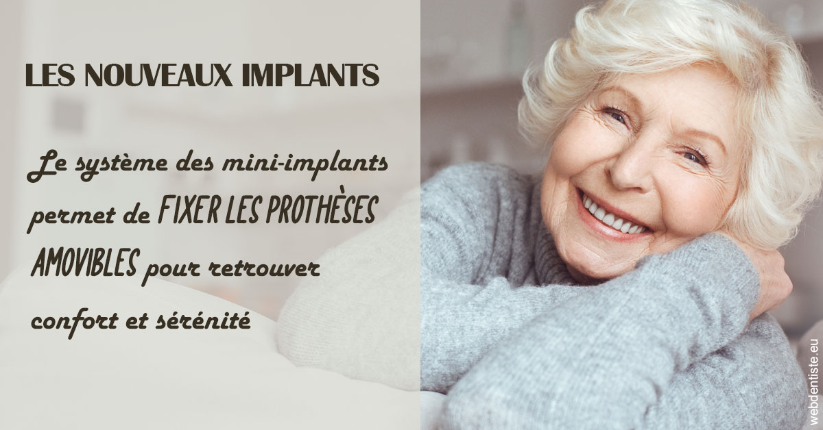 https://dr-tran-minh-hoa-cuc.chirurgiens-dentistes.fr/Les nouveaux implants 1