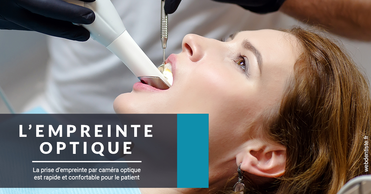 https://dr-tran-minh-hoa-cuc.chirurgiens-dentistes.fr/L'empreinte Optique 1