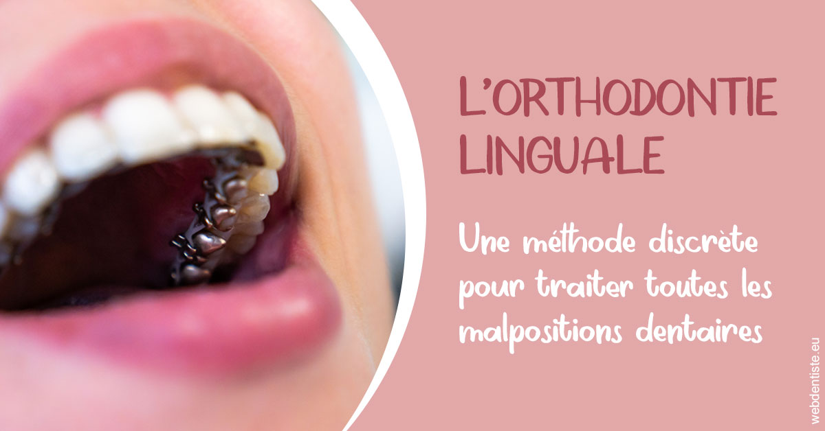 https://dr-tran-minh-hoa-cuc.chirurgiens-dentistes.fr/L'orthodontie linguale 2