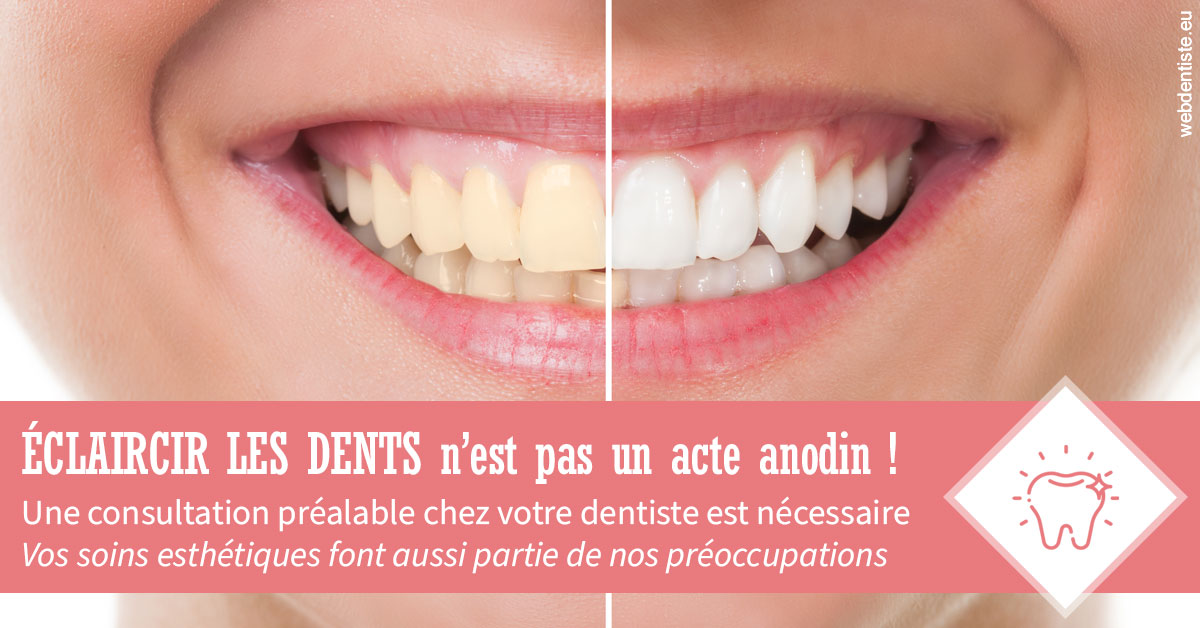 https://dr-tran-minh-hoa-cuc.chirurgiens-dentistes.fr/Eclaircir les dents 1