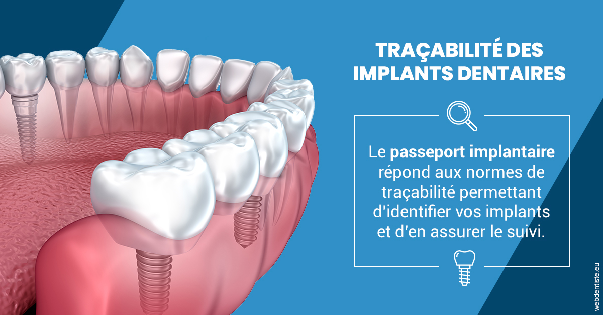 https://dr-tran-minh-hoa-cuc.chirurgiens-dentistes.fr/T2 2023 - Traçabilité des implants 1