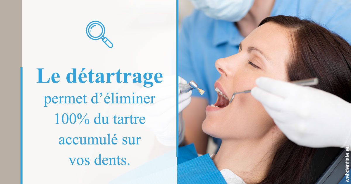 https://dr-tran-minh-hoa-cuc.chirurgiens-dentistes.fr/En quoi consiste le détartrage