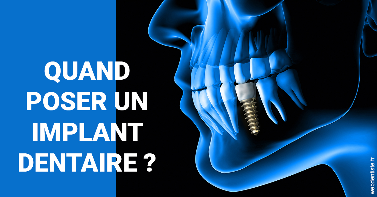 https://dr-tran-minh-hoa-cuc.chirurgiens-dentistes.fr/Les implants 1