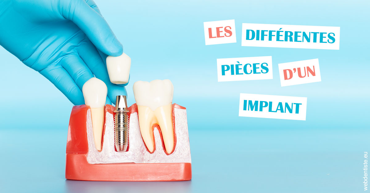https://dr-tran-minh-hoa-cuc.chirurgiens-dentistes.fr/Les différentes pièces d’un implant 2