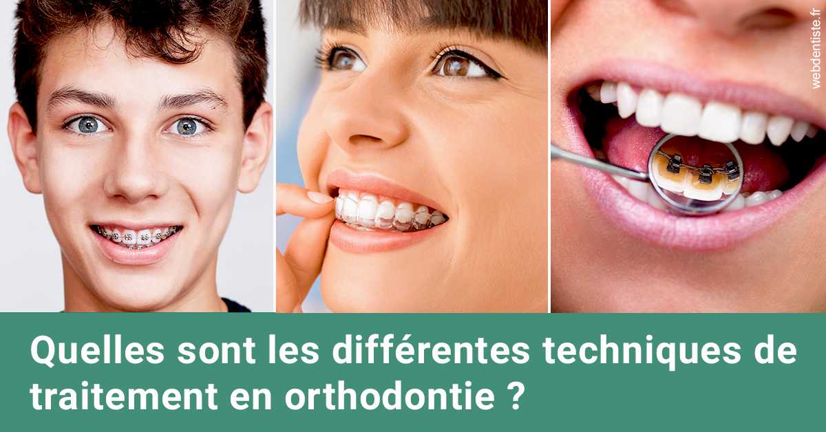 https://dr-tran-minh-hoa-cuc.chirurgiens-dentistes.fr/Les différentes techniques de traitement 2