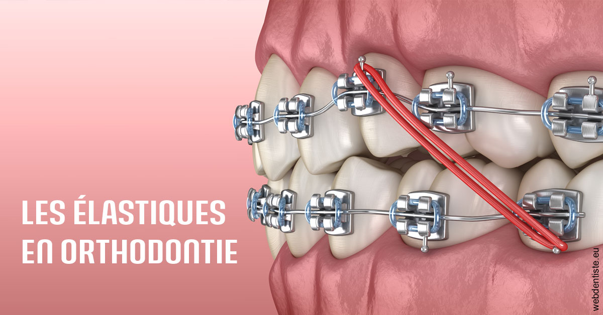https://dr-tran-minh-hoa-cuc.chirurgiens-dentistes.fr/Elastiques orthodontie 2