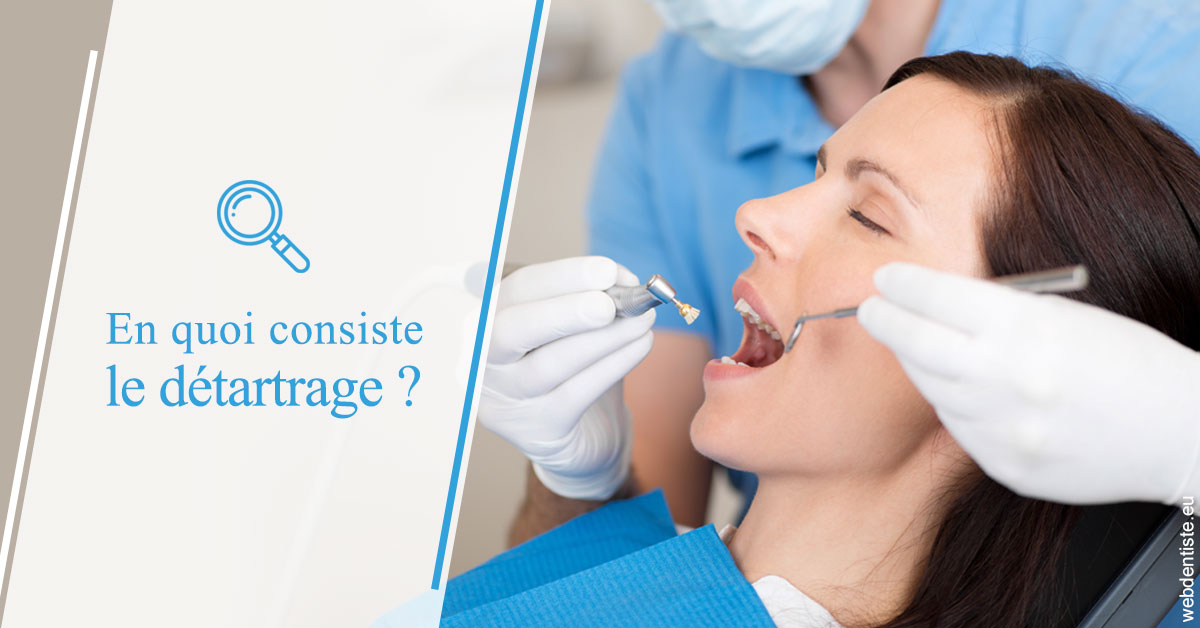 https://dr-tran-minh-hoa-cuc.chirurgiens-dentistes.fr/En quoi consiste le détartrage