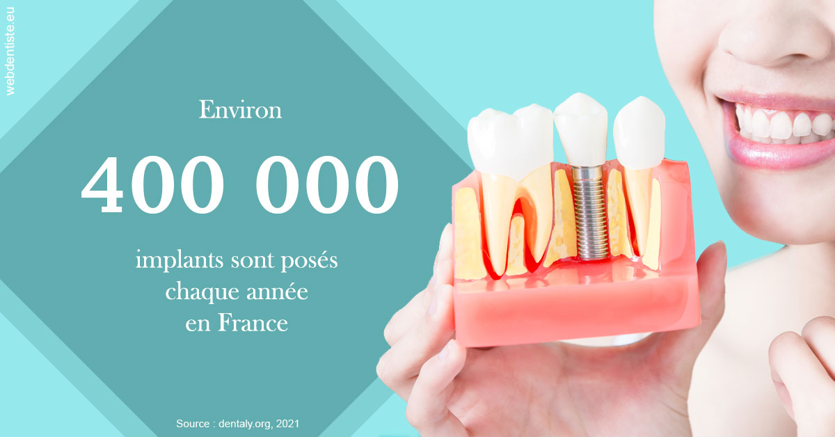 https://dr-tran-minh-hoa-cuc.chirurgiens-dentistes.fr/Pose d'implants en France 2